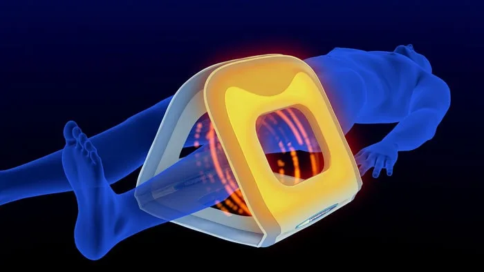 magnetoterapia